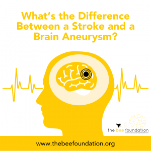 What’s the Difference Between a Stroke and a Brain Aneurysm?
