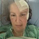 A person lying in a hospital bed with a bandaged forehead, wearing a hospital gown and looking at the camera.