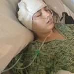 A woman lies in a hospital bed with medical bandages wrapped around her head and an oxygen tube in her nose, wearing a hospital gown.