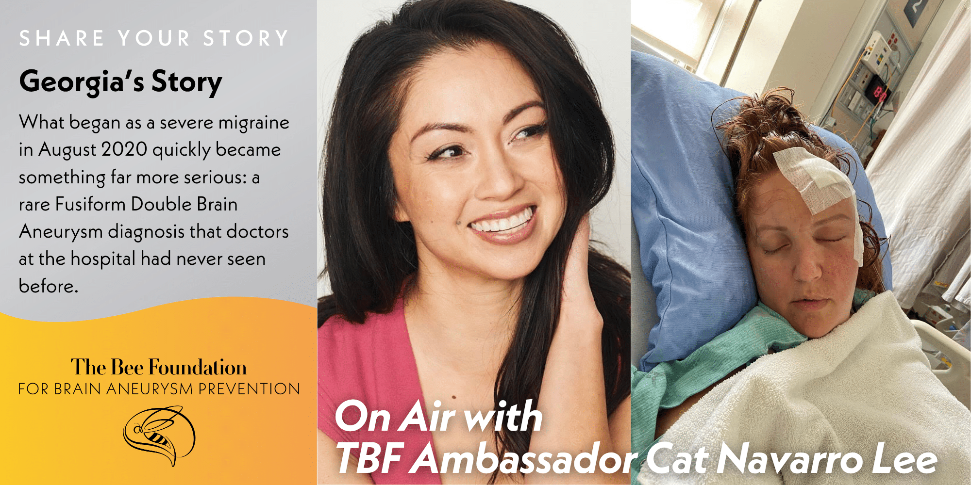 A split image: left side features smiling woman with text about Georgias rare brain aneurysm; right side shows woman in hospital bed with head bandaged; Bee Foundation logo at bottom left.