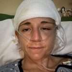 A person in a hospital bed with a bandaged head and an oxygen tube under their nose, wearing a hospital gown, looking directly at the camera.