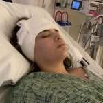 A person lies in a hospital bed with a bandaged head, wearing a hospital gown. Medical equipment and monitors are visible in the background, indicating a hospital setting and recent medical treatment.