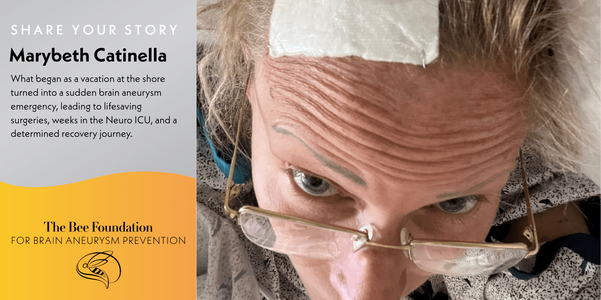 Close-up of a woman with a bandage on her forehead, wearing glasses, looking up at the camera. Text describes her sudden brain aneurysm emergency and recovery, shared by The Bee Foundation for Brain Aneurysm Prevention.