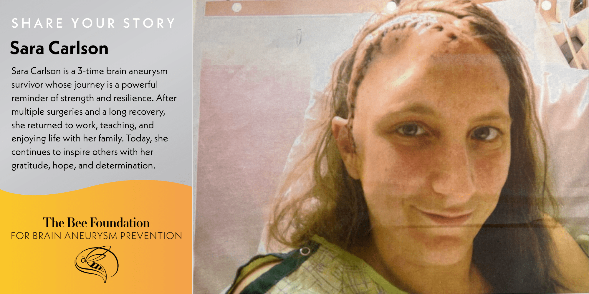 A woman with surgical scars on her scalp smiles beside text about her resilience after surviving three brain aneurysms; The Bee Foundation logo is at the bottom left.