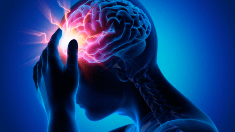 Subarachnoid hemorrhage