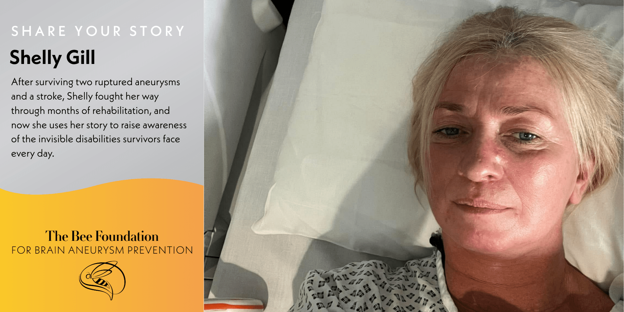A woman with light hair lies in a hospital bed, wearing a hospital gown, looking at the camera. Beside her, text shares her story as a brain aneurysm survivor and mentions The Bee Foundation for Brain Aneurysm Prevention.