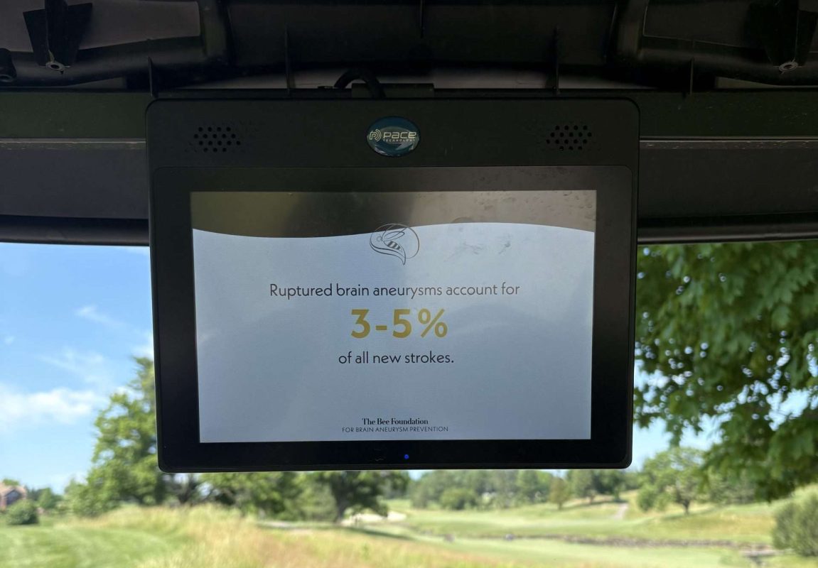 A screen on a golf cart displays a message: Ruptured brain aneurysms account for 3-5% of all new strokes. The cart is on a paved path surrounded by green grass and trees on a sunny day.